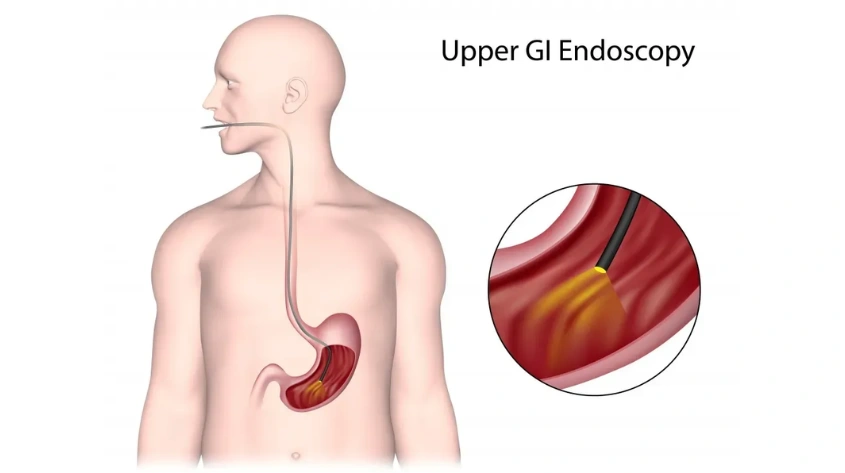 Endoscopy and colonoscopy in Kokapet