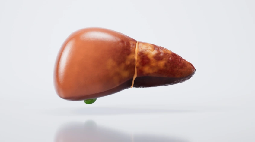 Fatty liver treatment in Kokapet
