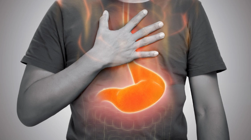 GERD acid reflux care in Kokapet