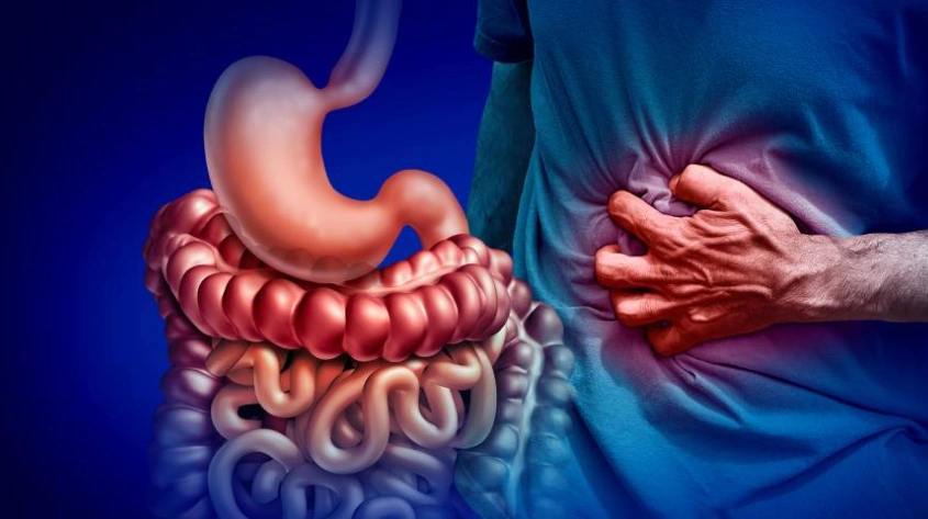 IBD Crohn’s and ulcerative colitis care